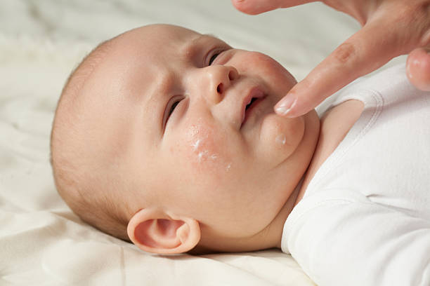 Piel atópica en bebés: cómo prevenirla y cuidarla con suavidad